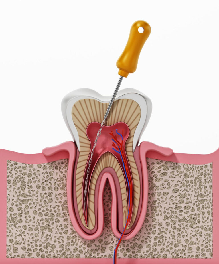 Endodonzia